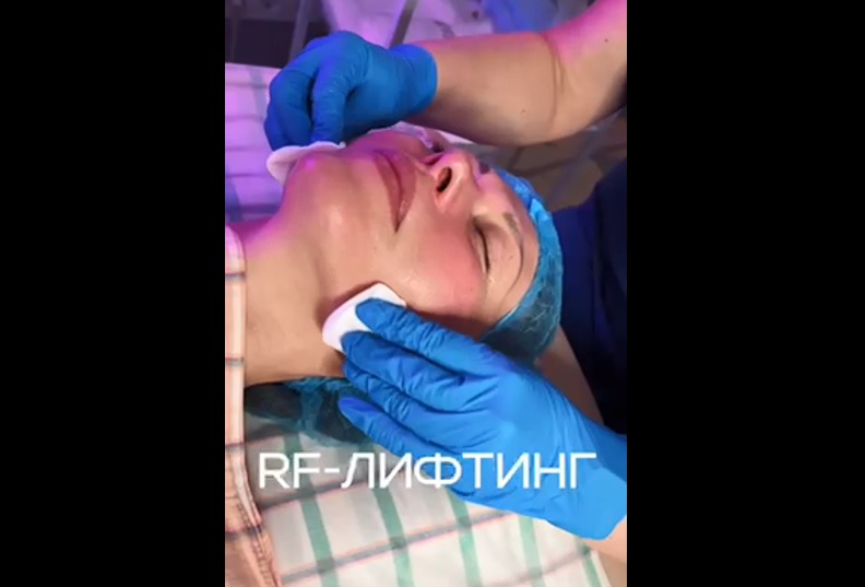 Современные технологии омолаживания